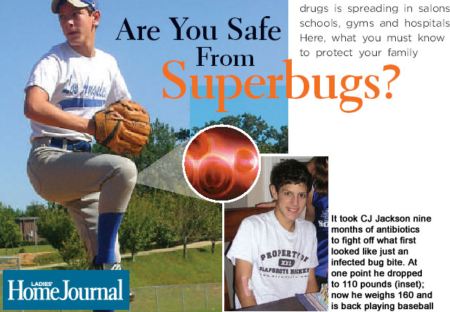 Are You Safe From Superbugs? It took CJ Jackson nine months of antibiotics to fight off what first looked like just an infected bug bite. At one point he dropped to 110 pounds (inset). now he weighs 160 and is back playing baseball